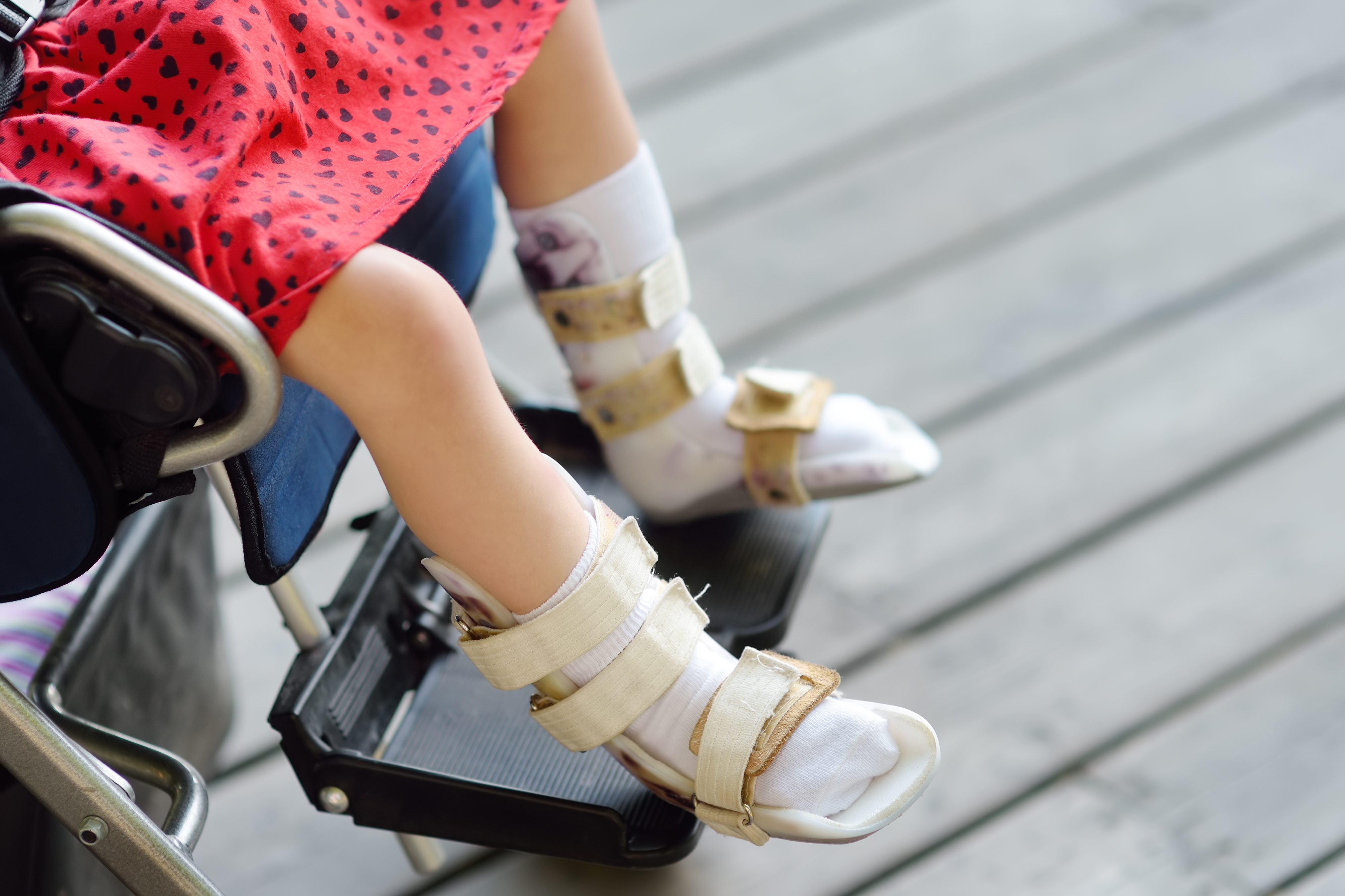 Curso de Órteses pare Membro Superior: Avançado